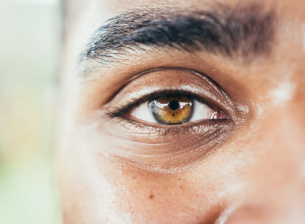 An enlarged image of a close-up of a male vybe urgent care patient's eye.
